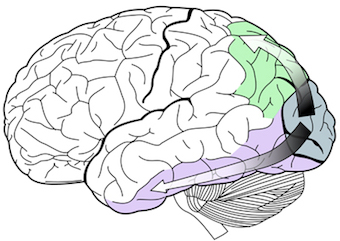 Diagram of human brain with two arrows emerging from  the rear (occipital lobe). The ventral stream goes to the side, along the temporal lobe, and the dorsal stream goes toward the top of the brain.